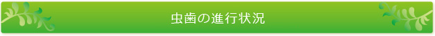 虫歯の進行状況